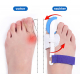 1 Paar Zehenspreizer Zehenkorrektur Hallux Valgus Schiene großer Zeh